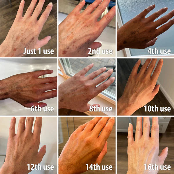 🌞Bee Poison & Ocean Natural Eczema Psoriasis Relief Cream (For all skin conditions)