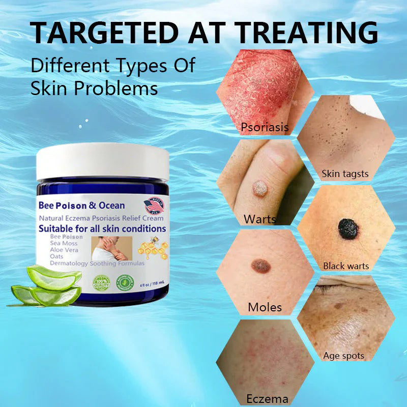🌞Bee Poison & Ocean Natural Eczema Psoriasis Relief Cream (For all skin conditions)