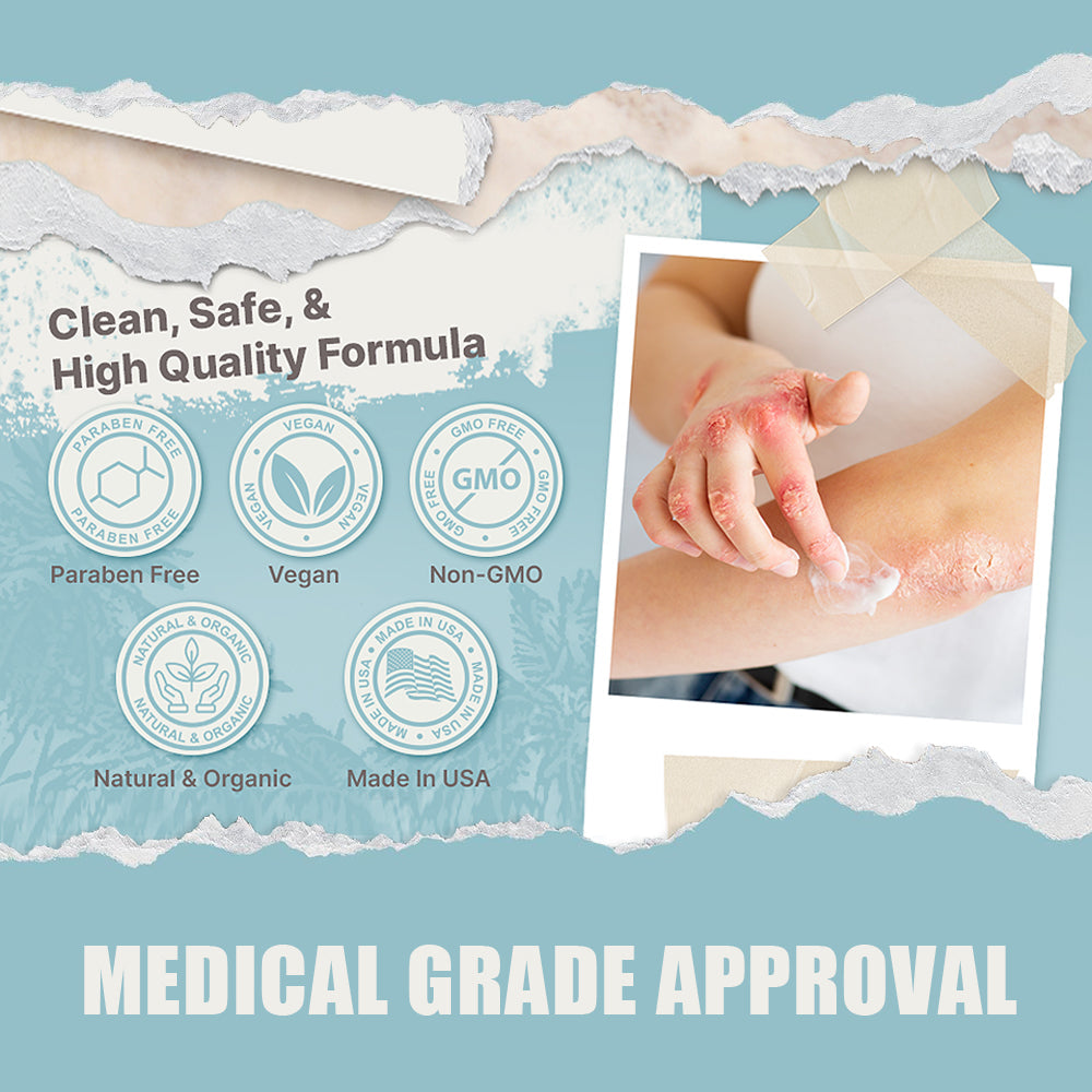 🌞Bee Poison & Ocean Natural Eczema Psoriasis Relief Cream (For all skin conditions)
