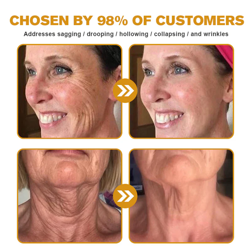✨FDA Approved:LOVILDS™ Bee Venom Skin Restoration Cream — 🔥Limited Time 70% OFF🔥