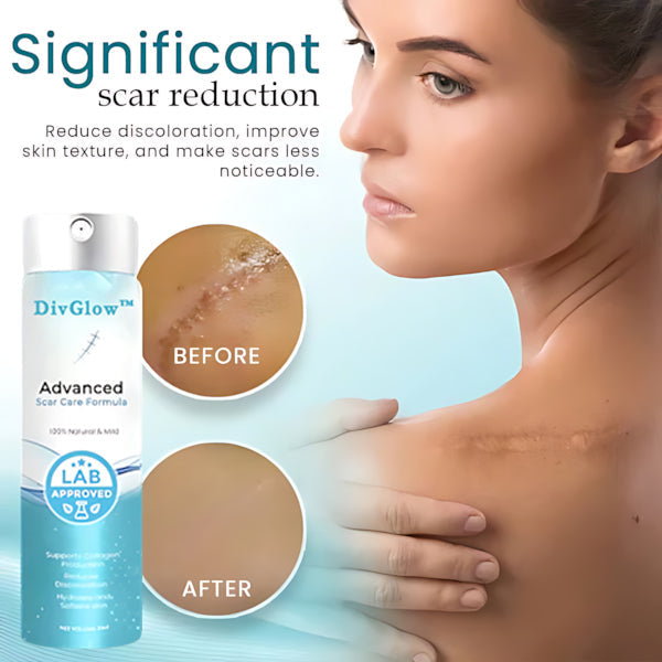 DivGlow™ Advanced Scar Care Formula