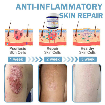 🌞Bee Poison & Ocean Natural Eczema Psoriasis Relief Cream (For all skin conditions)