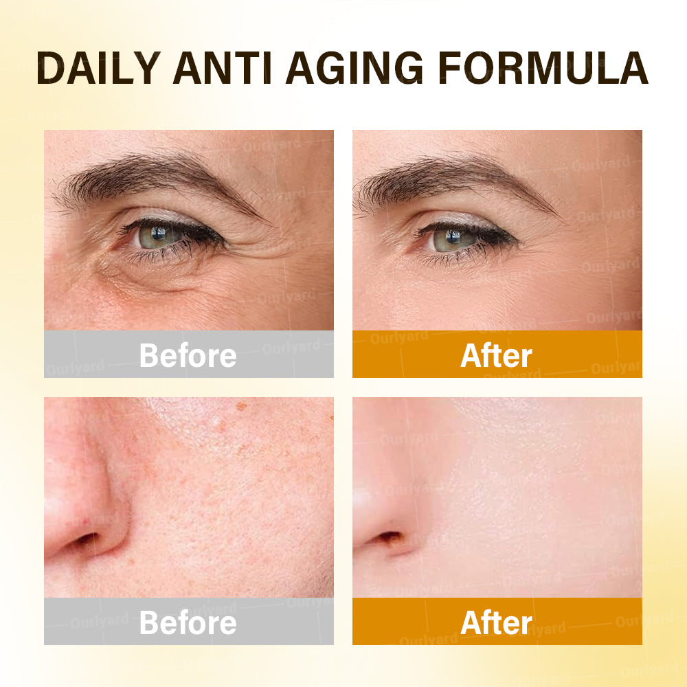 ✅Official Store |🦘👨‍⚕️  Anti-Aging Moisturizing Cream with Hyaluronic Acid, Retinol & Collagen – For Face, Neck, Décolleté & Legs – Made in Australia – Day & Night Use