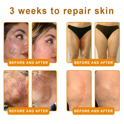 ✨FDA Approved:LOVILDS™  Bee Venom Skin Restoration Cream — 🔥Limited Time 70% OFF🔥