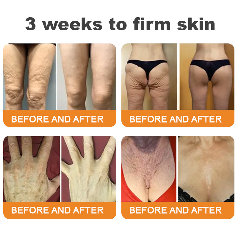 Made and Shipped from USA ✨ DivGlow® Bee Venom Skin Restoration Cream ⏰ LAST DAY 80% OFF