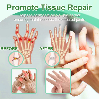 🎁𝐎𝐟𝐟𝐢𝐜𝐢𝐚𝐥 𝐒𝐭𝐨𝐫𝐞: DivGlow® Chillflex Mint Pain Relief Cream  (Treatment for arthritis, neuropathyy, rheumatic diseases, muscle spasms, twitches and sports injuries)