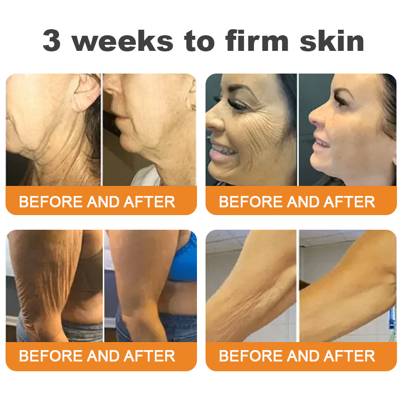 Made and Shipped from USA ✨ DivGlow® Bee Venom Skin Restoration Cream ⏰ LAST DAY 80% OFF