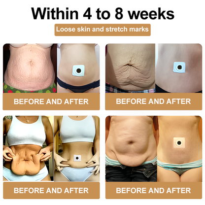 Lymphatic Drainage slimmingPatch (Suitable for use byindividuals of all ages)