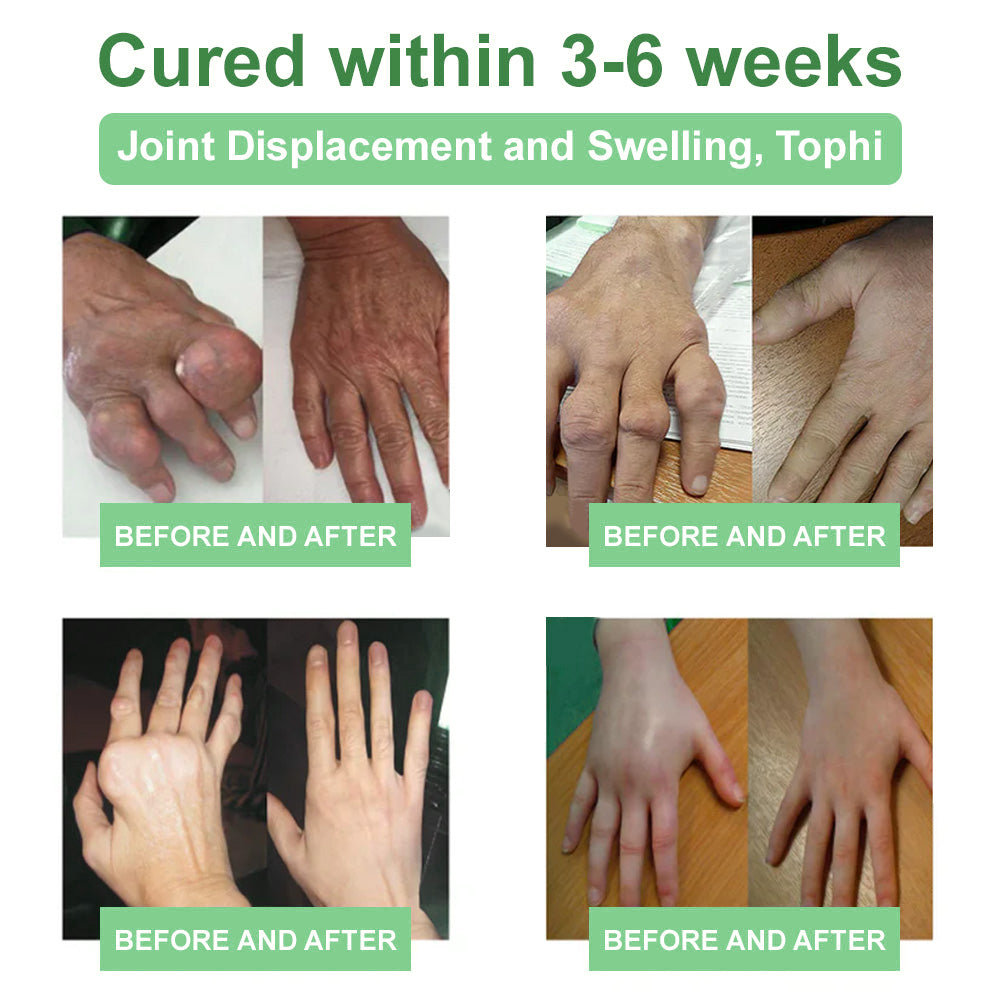 🎁𝐎𝐟𝐟𝐢𝐜𝐢𝐚𝐥 𝐒𝐭𝐨𝐫𝐞: DivGlow® Chillflex Mint Pain Relief Cream  (Treatment for arthritis, neuropathyy, rheumatic diseases, muscle spasms, twitches and sports injuries)