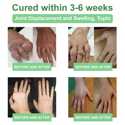 🎁𝐎𝐟𝐟𝐢𝐜𝐢𝐚𝐥 𝐒𝐭𝐨𝐫𝐞: DivGlow® Chillflex Mint Pain Relief Cream  (Treatment for arthritis, neuropathyy, rheumatic diseases, muscle spasms, twitches and sports injuries)