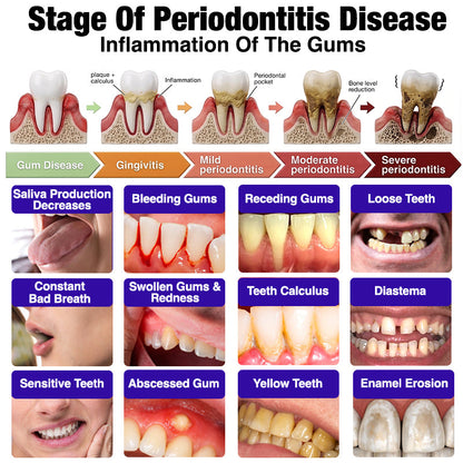Rolimey® VioCore Bee Venom Gingivitis & Periodontitis Treatment Toothpaste